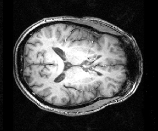 Parker's brain - section-2-550